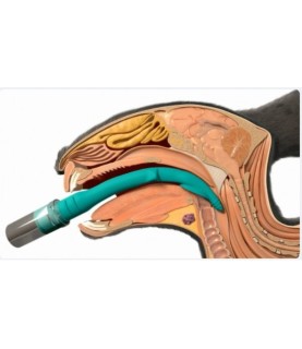 V-GEL ADVANCED dispositivo sopraglottideo monouso per vie respiratorie/aeree