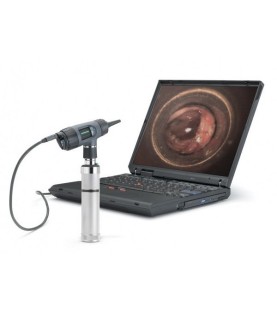 OTO-VIDEO WELCH ALLYN DIGITAL MACROVIEW