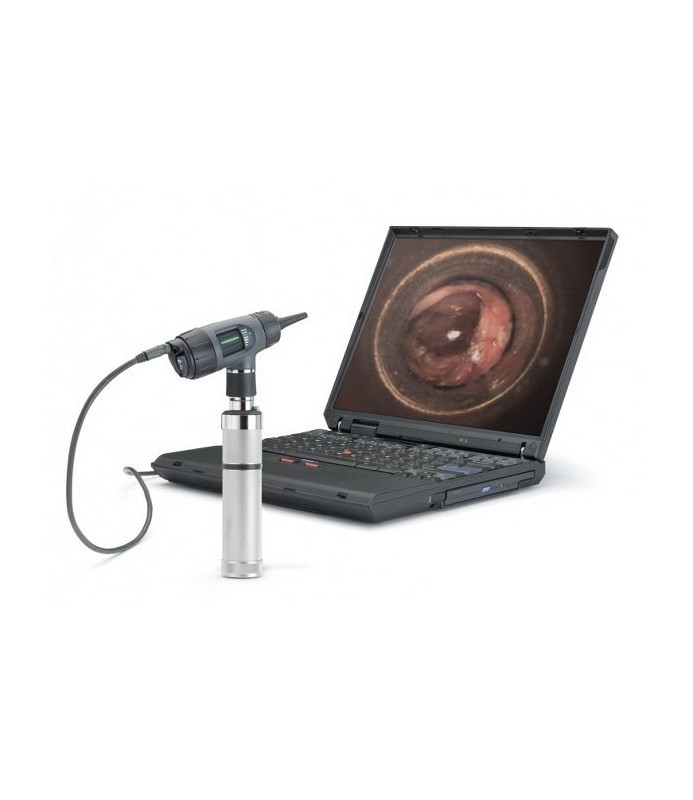 OTO-VIDEO WELCH ALLYN DIGITAL MACROVIEW